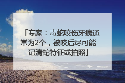 专家：毒蛇咬伤牙痕通常为2个，被咬后尽可能记清蛇特征或拍照